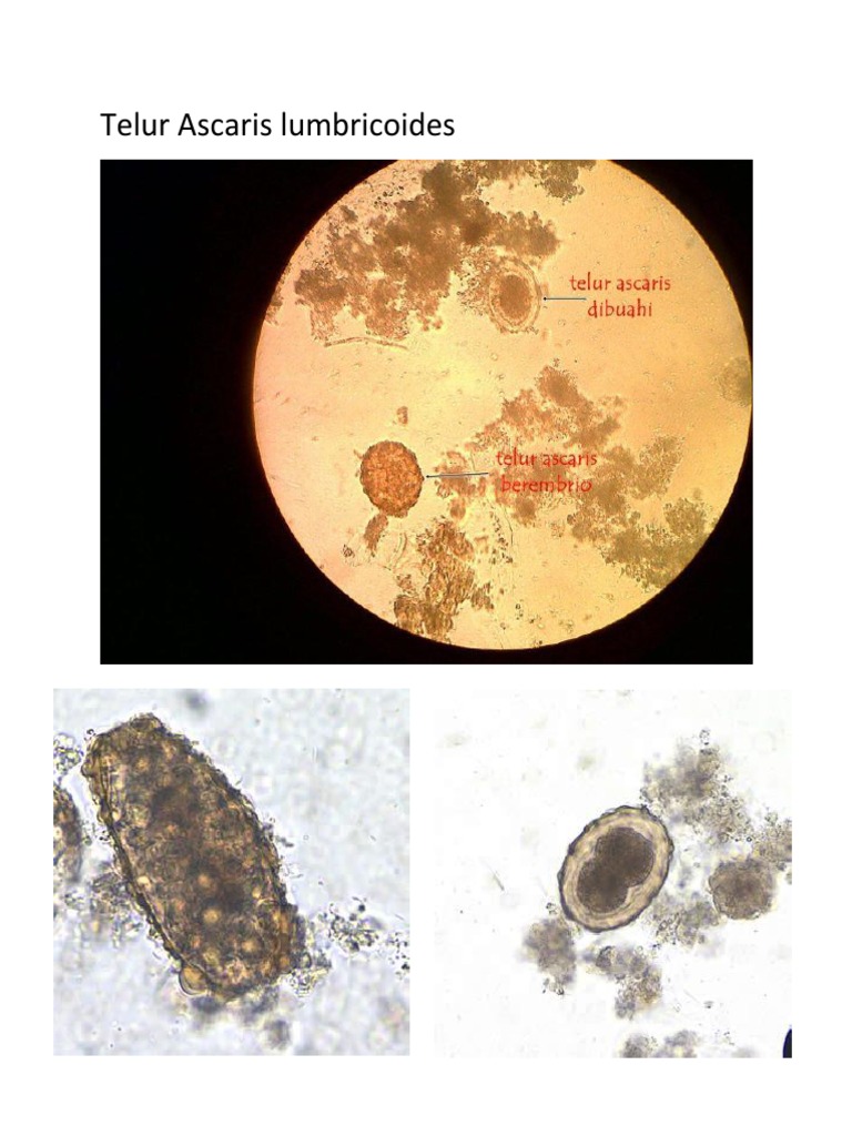 Detail Gambar Telur Cacing Ascaris Lumbricoides Nomer 15
