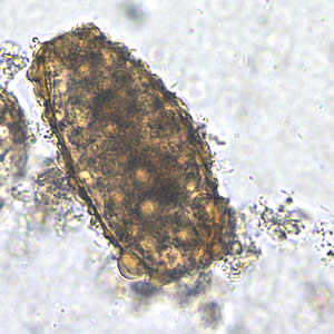 Detail Gambar Telur Cacing Ascaris Lumbricoides Nomer 2