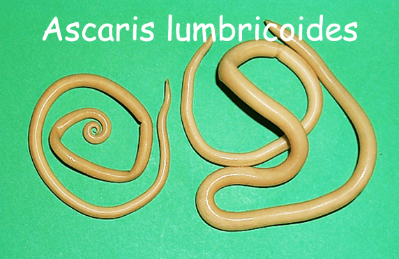 Detail Gambar Telur Cacing Ascaris Lumbricoides Nomer 19