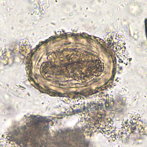 Detail Gambar Telur Cacing Ascaris Lumbricoides Nomer 23