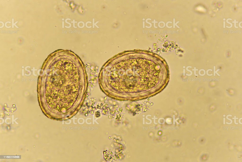 Detail Gambar Telur Cacing Ascaris Lumbricoides Nomer 28