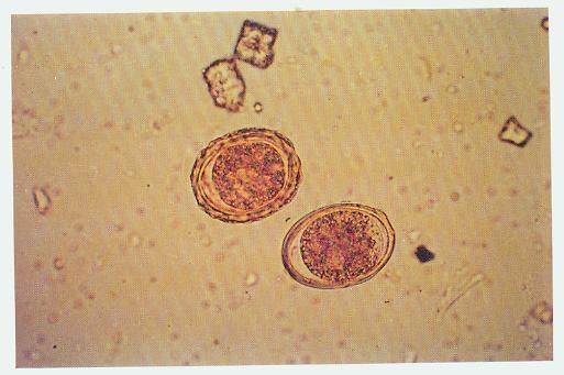 Detail Gambar Telur Cacing Ascaris Lumbricoides Nomer 32