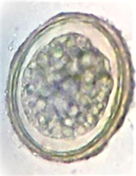 Detail Gambar Telur Cacing Ascaris Lumbricoides Nomer 35