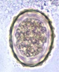 Detail Gambar Telur Cacing Ascaris Lumbricoides Nomer 37