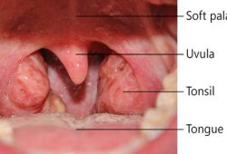 Detail Gambar Tenggorokan Sehat Nomer 26