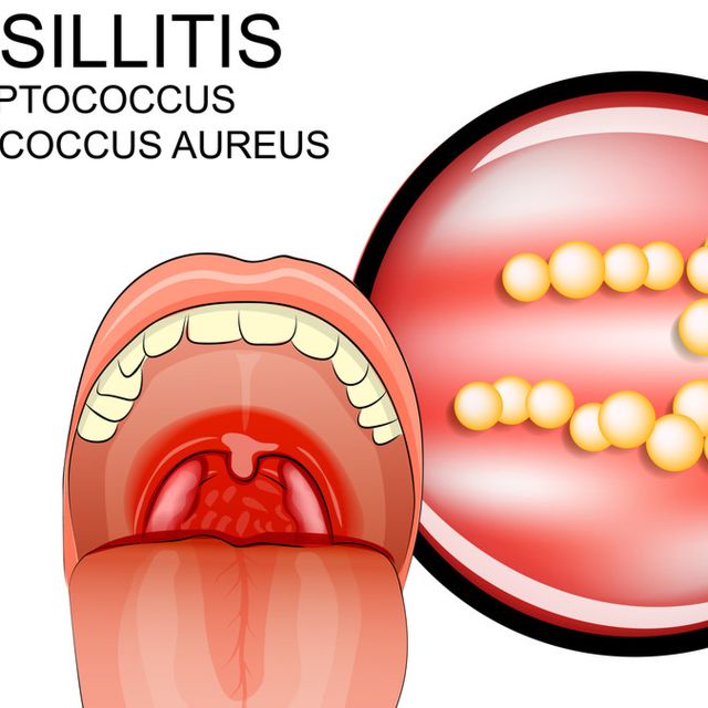 Detail Gambar Tenggorokan Sehat Nomer 5