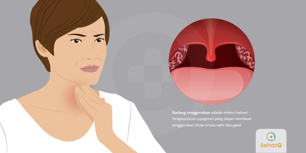 Detail Gambar Tenggorokan Sehat Dan Tidak Sehat Nomer 18