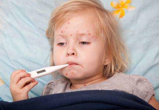 Detail Gambar Tentang Meningitis Pada Anak Nomer 25