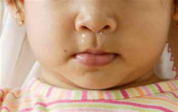 Detail Gambar Tentang Meningitis Pada Anak Nomer 39
