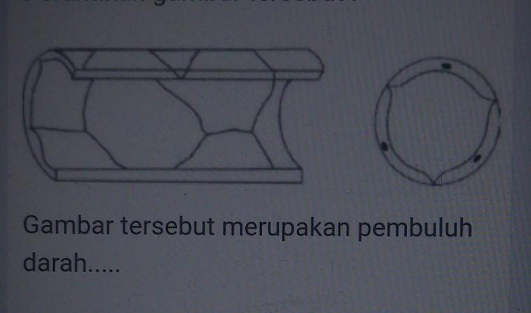 Detail Gambar Tersebut Merupakan Pembuluh Darah Nomer 2