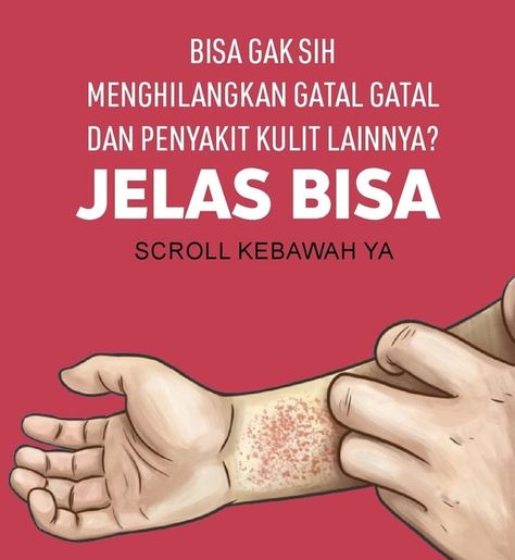 Detail Gambar Tes Pergelangan Tangan Nomer 31