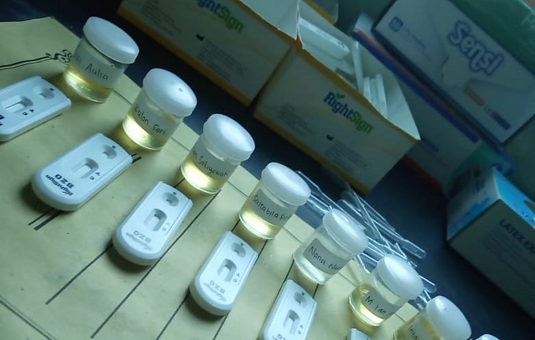 Detail Gambar Tes Urine Positif Narkoba Nomer 9