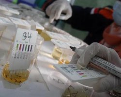Detail Gambar Tes Urine Positif Narkoba Nomer 23