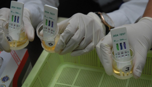 Detail Gambar Tes Urine Positif Narkoba Nomer 25