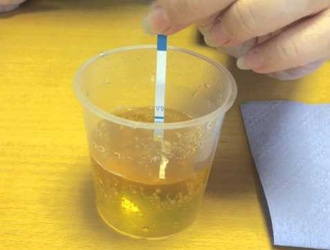 Detail Gambar Tes Urine Positif Narkoba Nomer 29