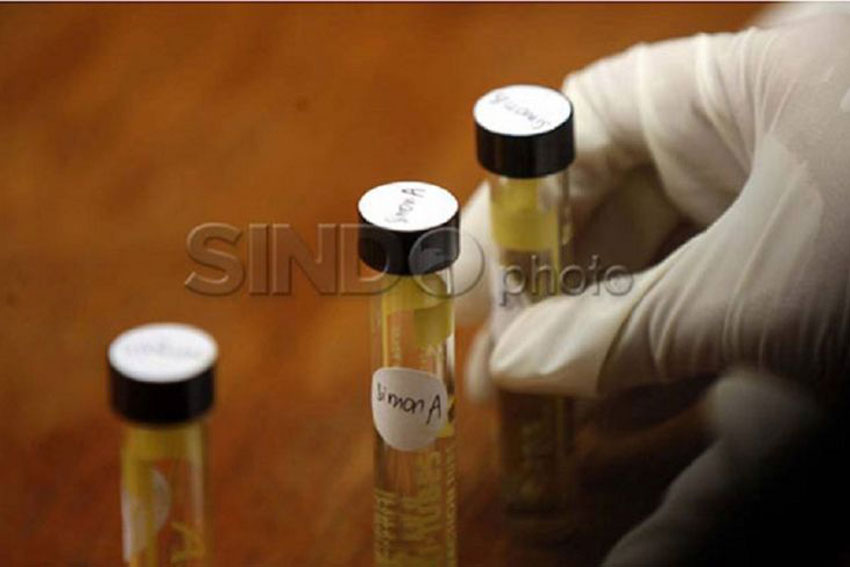 Detail Gambar Tes Urine Positif Narkoba Nomer 32