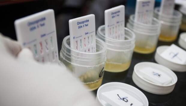 Detail Gambar Tes Urine Positif Narkoba Nomer 37