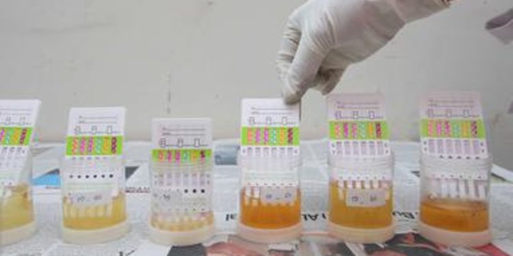 Detail Gambar Tes Urine Positif Narkoba Nomer 39