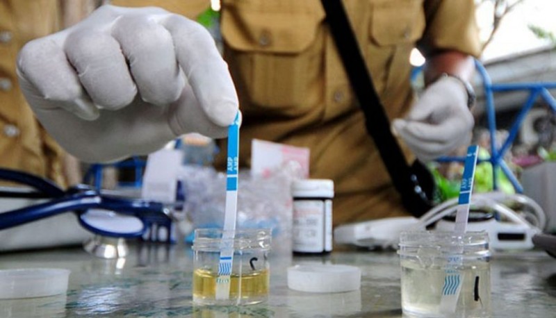 Detail Gambar Tes Urine Positif Narkoba Nomer 4