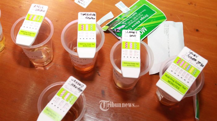 Detail Gambar Tes Urine Positif Narkoba Nomer 44
