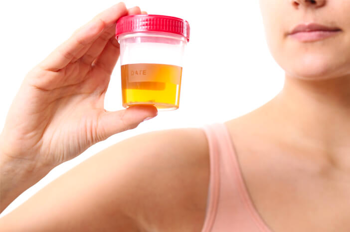 Detail Gambar Tes Urine Positif Narkoba Nomer 45