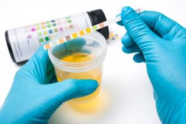 Detail Gambar Tes Urine Positif Narkoba Nomer 46