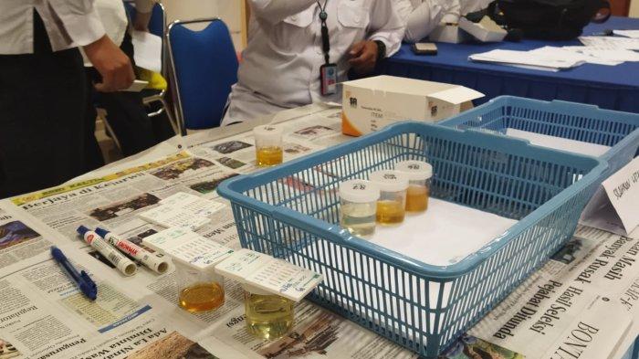 Detail Gambar Tes Urine Positif Narkoba Nomer 51
