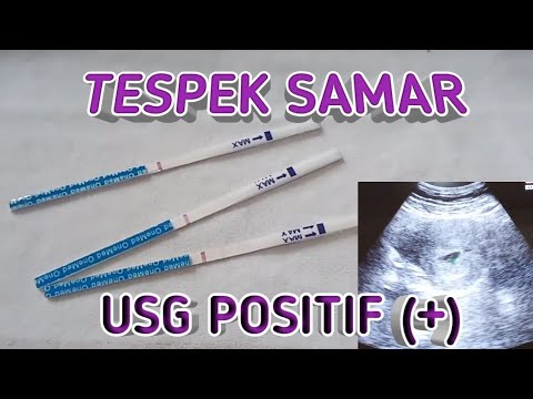 Detail Gambar Tespek Positif Samar Nomer 14