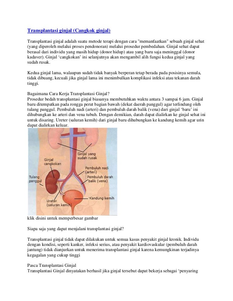 Detail Gambar Transplantasi Ginjal Nomer 37