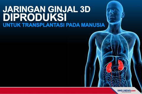 Detail Gambar Transplantasi Ginjal Nomer 49