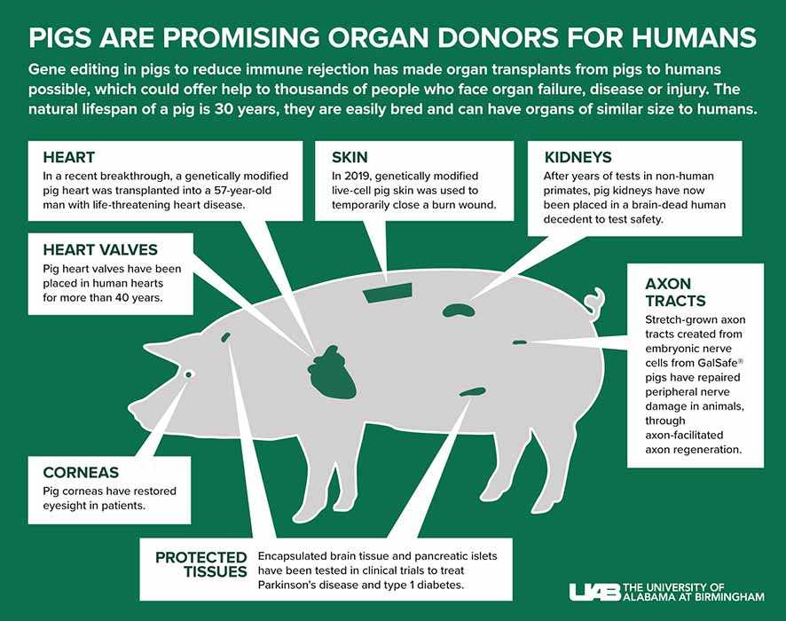 Detail Gambar Transplantasi Ginjal Nomer 51