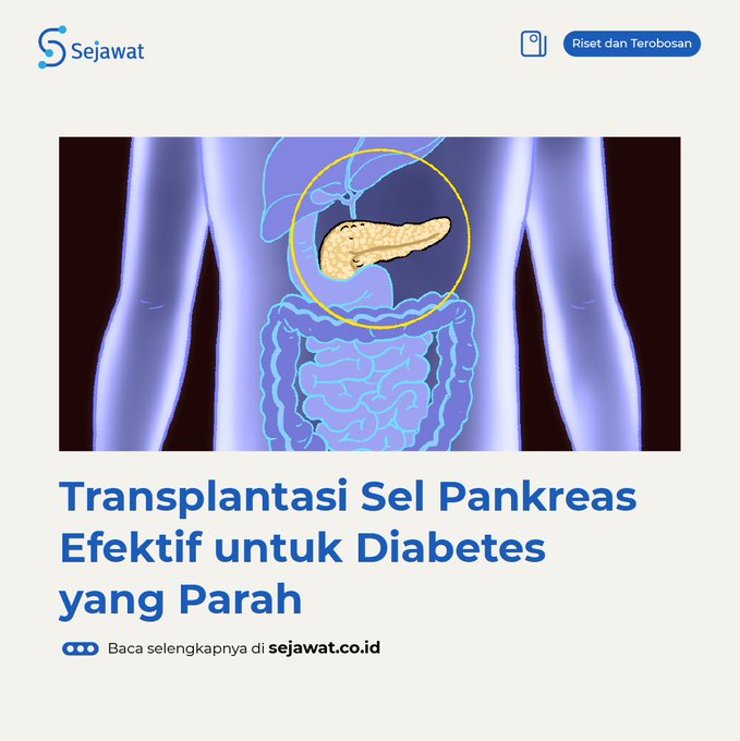 Detail Gambar Transplantasi Pankreas Nomer 24