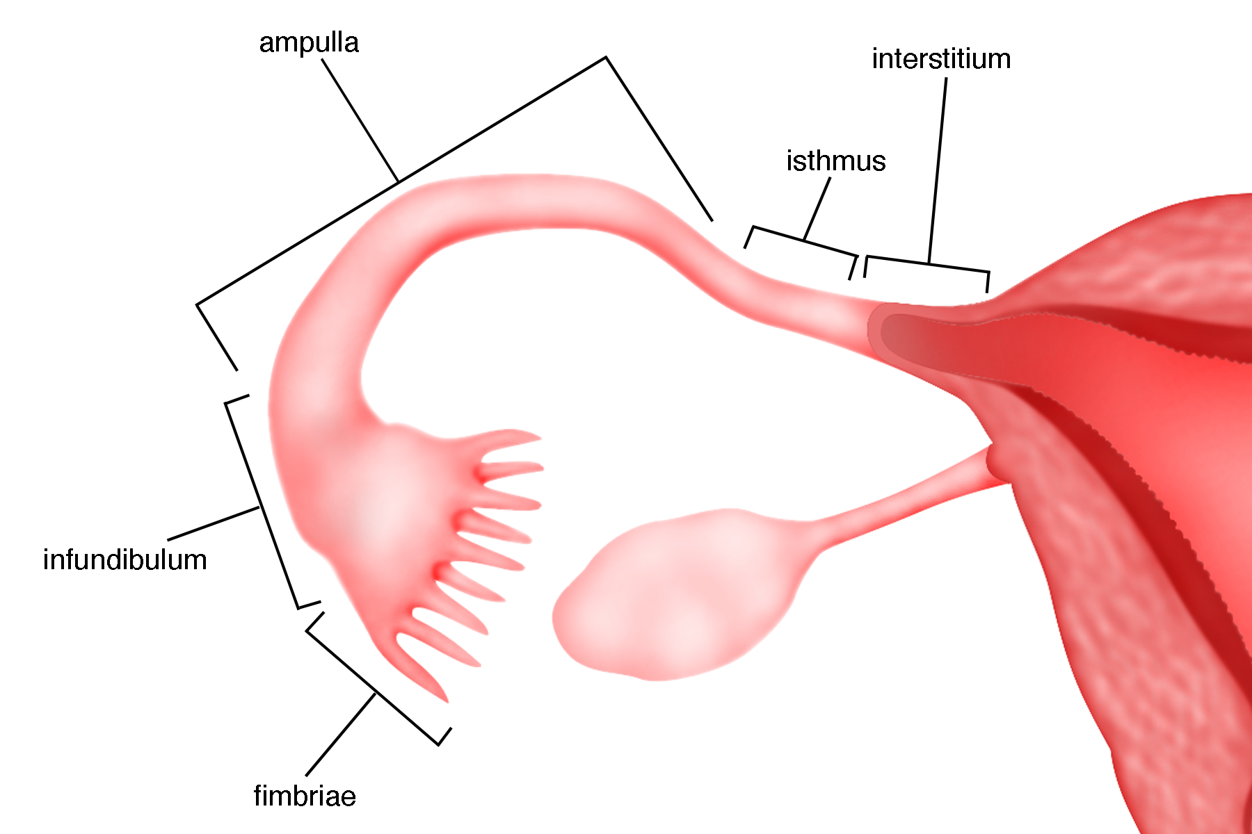 Detail Gambar Tuba Fallopi Nomer 7