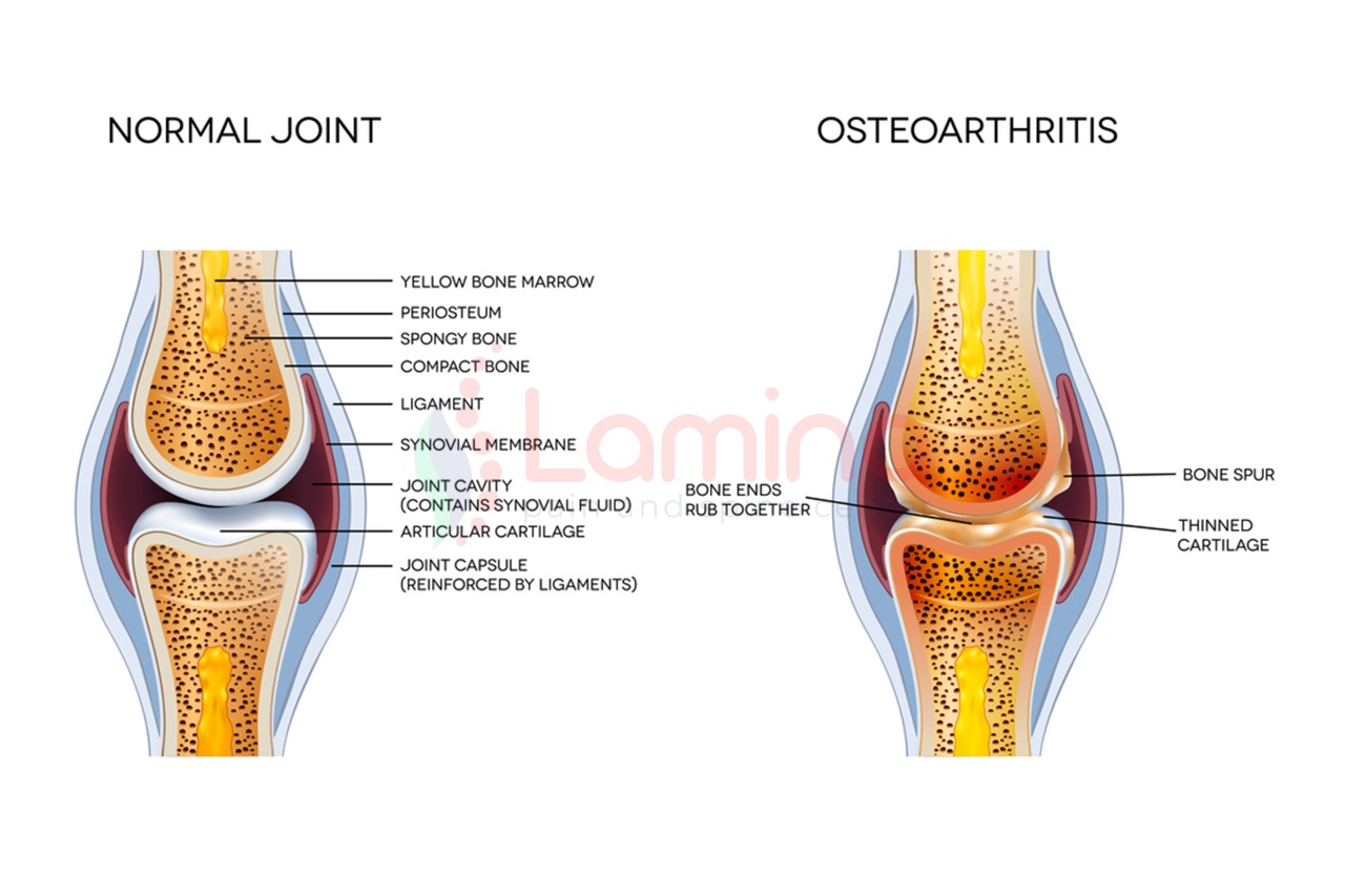 Detail Gambar Tulang Dan Sendi Nomer 5