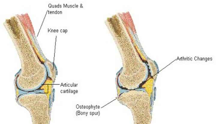 Detail Gambar Tulang Diartrosis Nomer 24