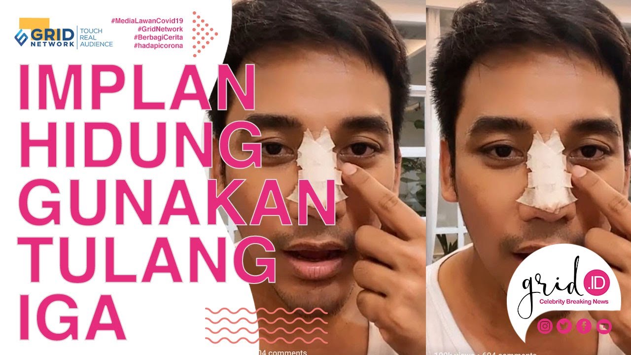 Detail Gambar Tulang Hidung Nomer 24