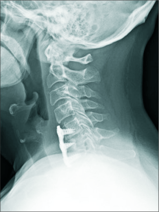 Detail Gambar Tulang Leher Nomer 28