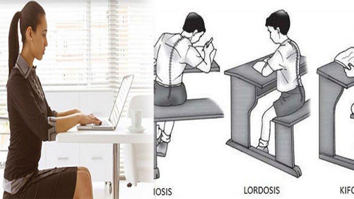 Detail Gambar Tulang Lordosis Nomer 18