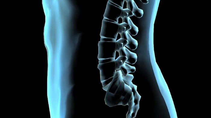 Detail Gambar Tulang Lordosis Nomer 37