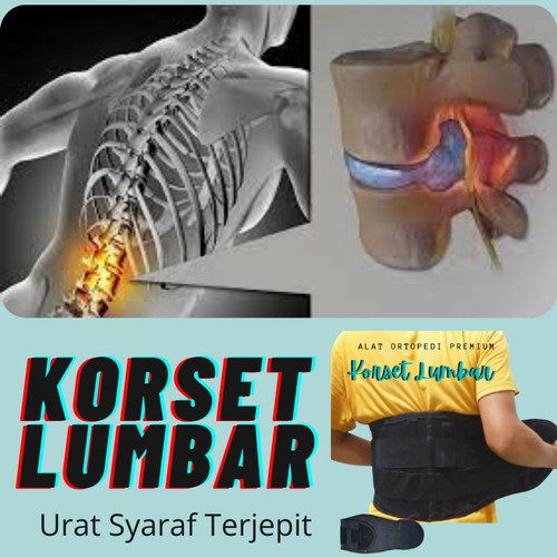 Detail Gambar Tulang Lumbal Nomer 24