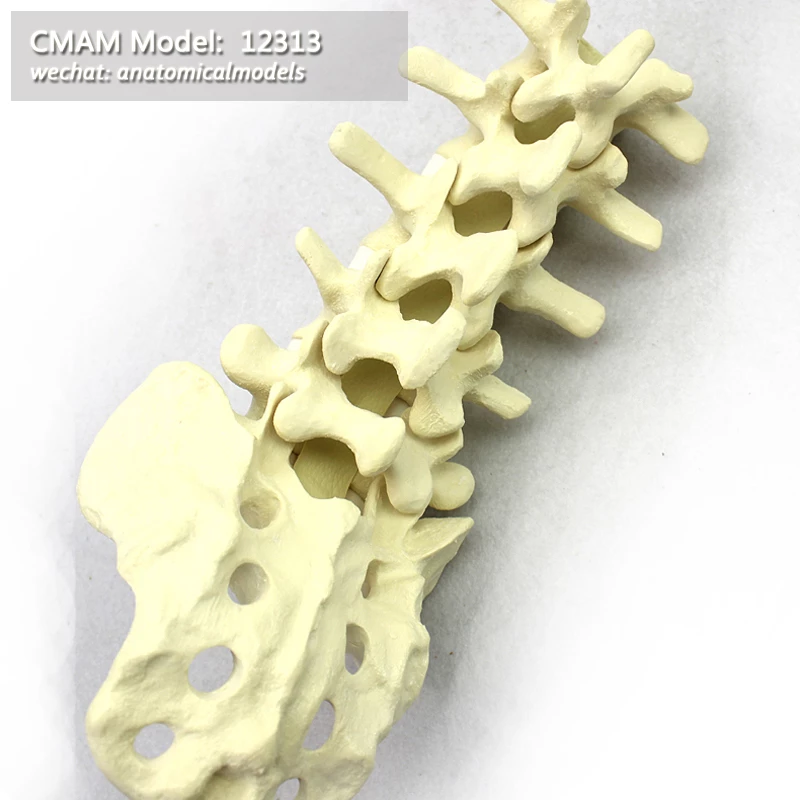 Detail Gambar Tulang Lumbal Nomer 35