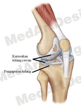 Detail Gambar Tulang Lutut Nomer 18