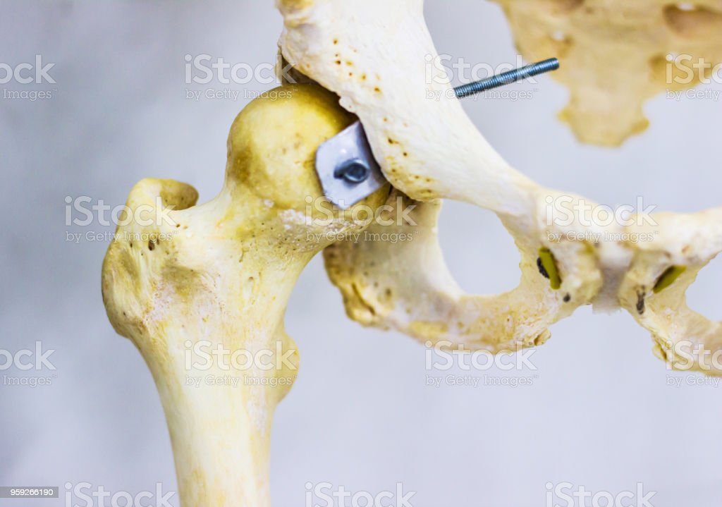 Detail Gambar Tulang Paha Nomer 37