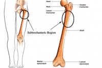 Detail Gambar Tulang Paha Nomer 48