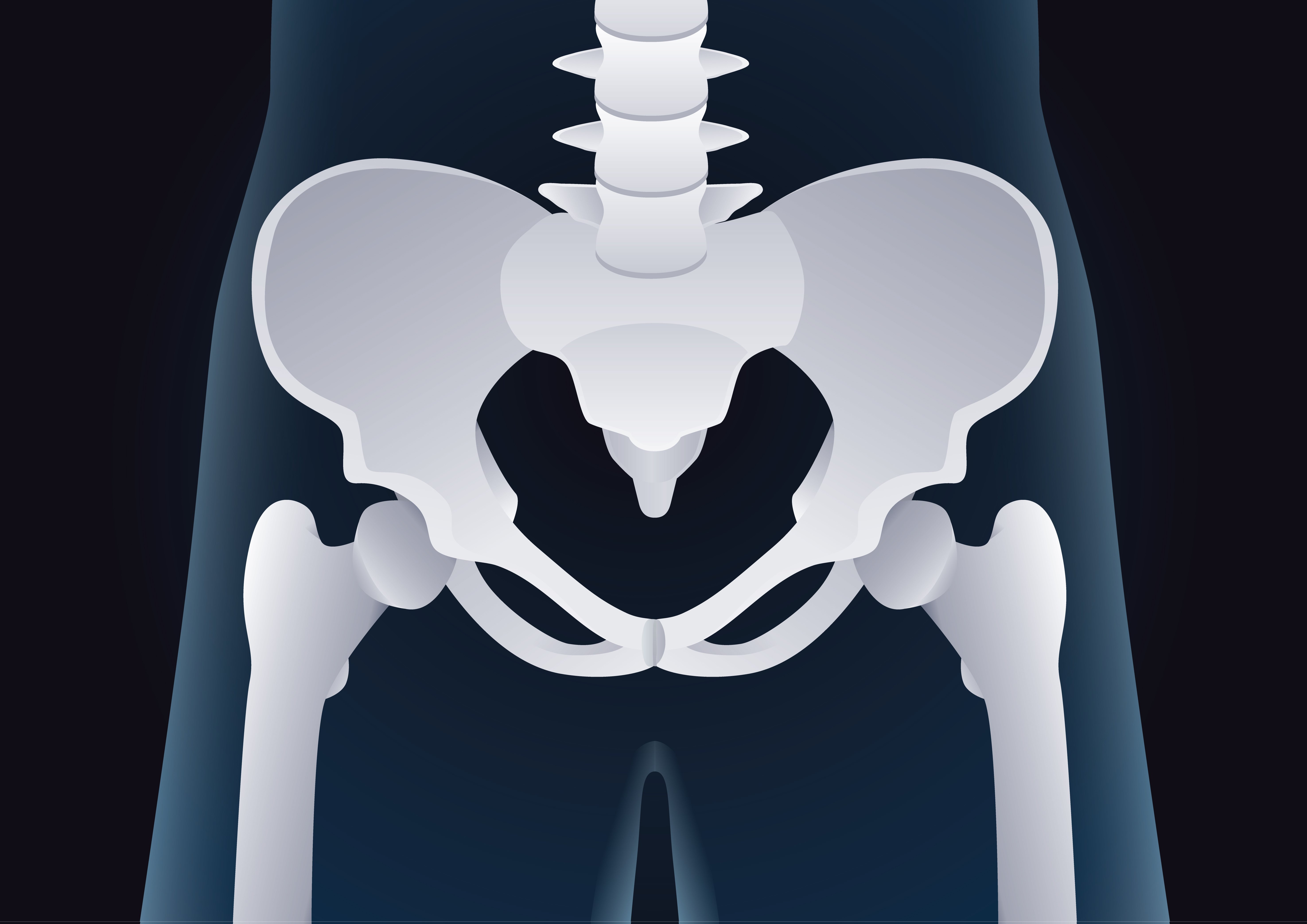 Detail Gambar Tulang Panggul Wanita Nomer 35