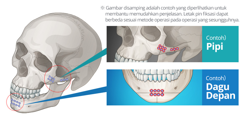 Detail Gambar Tulang Pipi Nomer 41