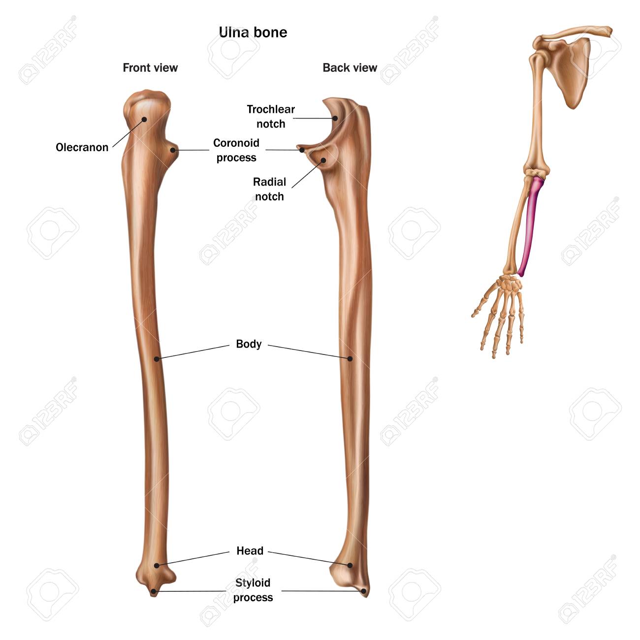 Detail Gambar Tulang Radius Nomer 15