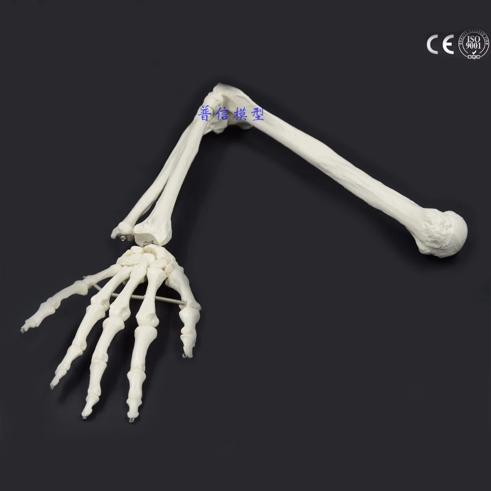 Detail Gambar Tulang Radius Nomer 45