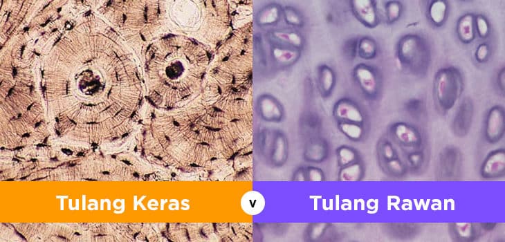 Detail Gambar Tulang Rawan Dan Tulang Keras Nomer 2