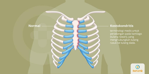 Detail Gambar Tulang Rusuk Dan Tulang Dada Nomer 15